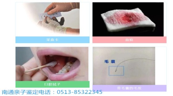 南通亲子鉴定怎么做？南通正规DNA鉴定机构